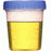 Buy Dynarex Urine Specimen Collection Cup, Sterile Individually wrapped  online at Mountainside Medical Equipment