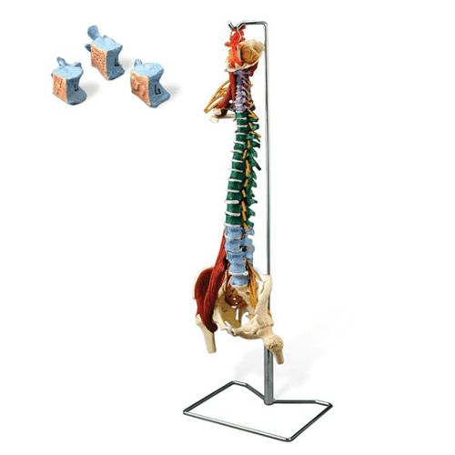 Buy n/a Muscle Spine with Disorders with Stand  online at Mountainside Medical Equipment