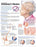 Buy n/a Understanding Alzheimer's Disease Informational Poster  online at Mountainside Medical Equipment