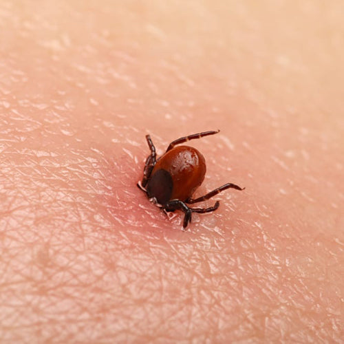 Lyme Disease Symptoms and Treatment Options