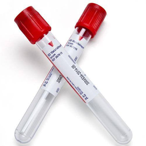 Close-up of Serum Blood Collection Tubes with precision markings used for accurate diagnostics, ensuring reliable lab results.