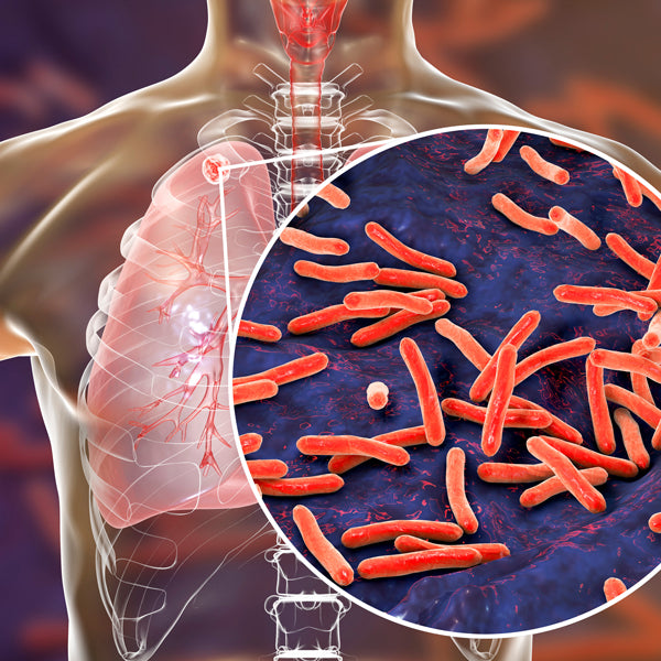 Tuberculosis disease in body