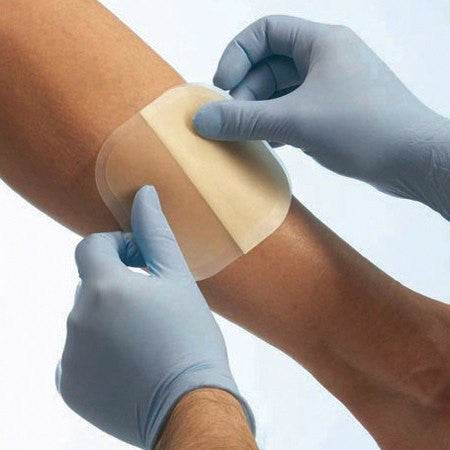 Pressure Ulcer Dressings offering protection and moisture control for enhanced wound healing and effective recovery.