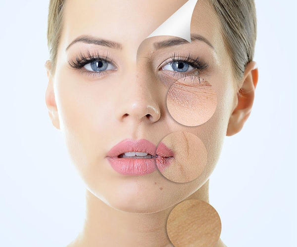 Anti-Aging Products: Reduce Wrinkles and Signs of Aging  Mountainside  Medical