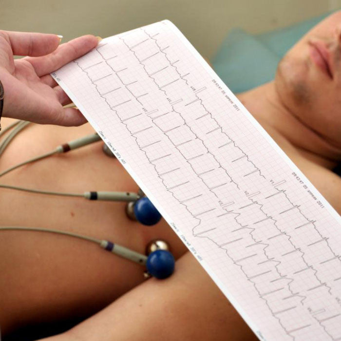 ECG Machine Electrodes