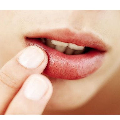 Cold Sore Treatments