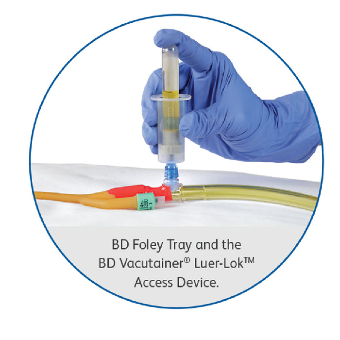 Buy BD BD Vacutainer IV Access Device Holder with Pre-Attached Multiple Sample Adapter  online at Mountainside Medical Equipment