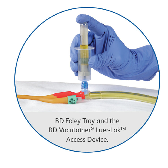 BD Vacutainer Luer-Lok Access Device — Mountainside Medical