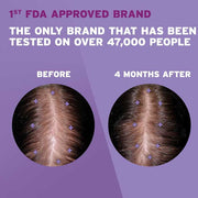 Before and after pictues using Women's Rogaine 2% Minoxidil Topical Solution Treatment 