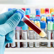 Here you will find blood collection supplies like blood collection tubes, butterfly needles, blood collection sets, coban wraps, and cotton swabs.