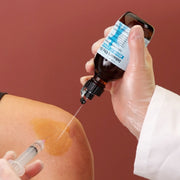 Spraying Gebauer Ethyl Chloride on the knee before a cortisone injection.