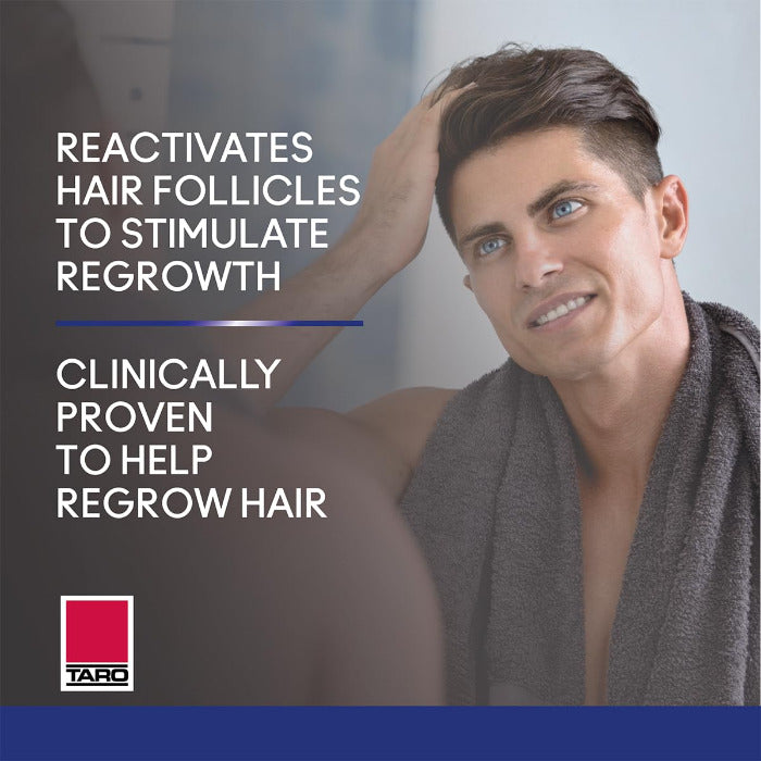 Minoxidil Foam Regrows hair follicles to stimulate growth