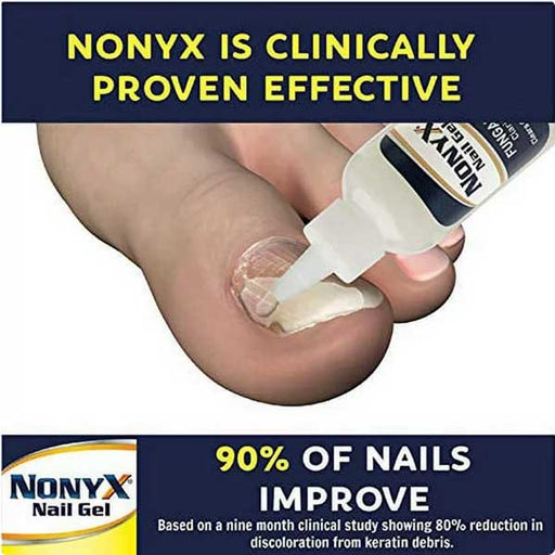 Nonyx is Clinically Proven Effective against Nail Fungas
