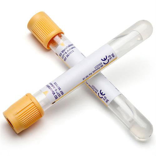 Blood Collection Tubes | Color-Coded Phlebotomy & Lab Supplies ...