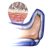 Illustration of heel pressure relief showing skin and tissue protection, with a focus on cushioning and pressure distribution for heel support