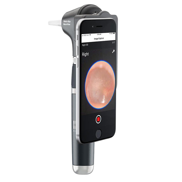 Welch Allyn MacroView Basic Otoscope