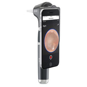 Welch Allyn MacroView Plus Otoscope with Cellphone