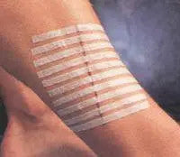 Buy 3M Healthcare Steri-Strip Reinforced Skin Closures R1547  online at Mountainside Medical Equipment