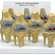 Four Stages of Osteoarthritis Model in The Knee Joint