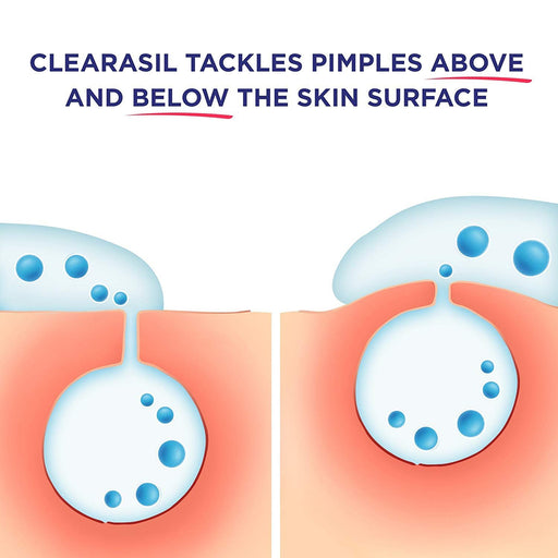 Buy RB Health Clearasil Ultra Rapid Action Cleansing Skin Pads, 90 Count  online at Mountainside Medical Equipment