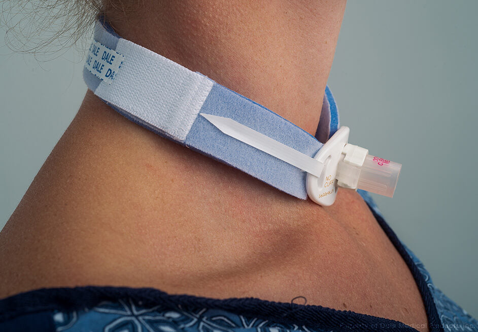 Tracheostomy Tube Holder secures airway devices safely, enhancing patient comfort and respiratory care.