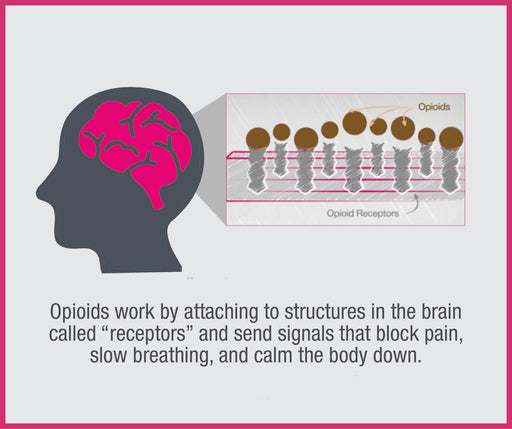 Illustration that shows how opioids work by attaching to brain receptors, affecting pain relief and causing addiction.