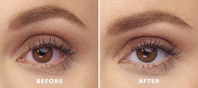 Before and After using Lumify Redness Reliever Eye Drops