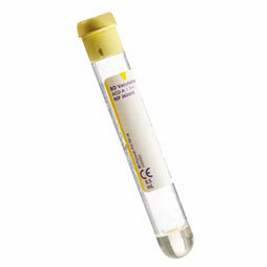 トップス YELLO DISTRESSED BLOOD TYPE SET UP Venous Blood Collection Tube ACD Solution A Additive 6 mL, Yellow