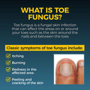 Buy Emerson Healthcare Fungi-Nail Antifungal Nail & Athlete’s Foot Ointment  online at Mountainside Medical Equipment