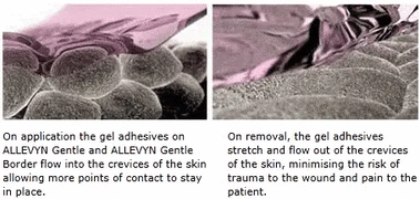 Buy Smith & Nephew Allevyn™ Life Silicone Gel Adhesive Foam Border Dressings, 10/bx  online at Mountainside Medical Equipment
