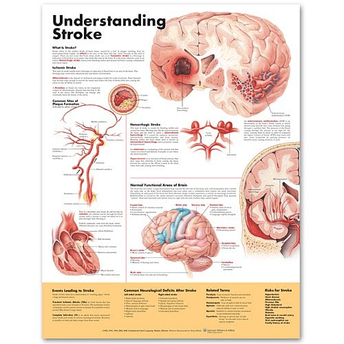 Buy Anatomical Chart Company Anatomy Poster Wall Charts  online at Mountainside Medical Equipment