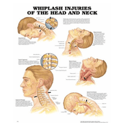Buy Anatomical Chart Company Anatomy Poster Wall Charts  online at Mountainside Medical Equipment