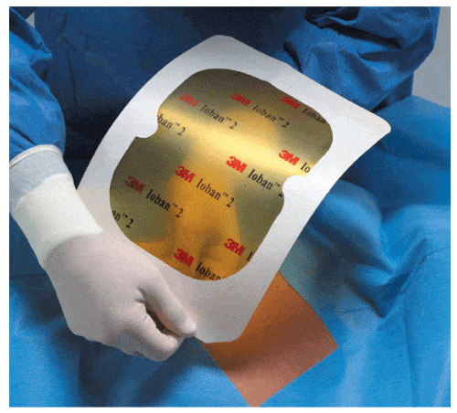 ioban dressing 3M™ IOBAN™ 2 Antimicrobial Incise Drape 35” x 23” 10/box