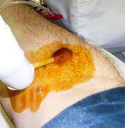 Buy Select Brand Povidone Iodine Solution Swabstick Antiseptic Applicators 3's  online at Mountainside Medical Equipment