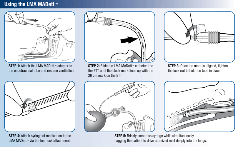 Endotracheal Intubation Equipment