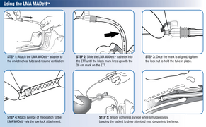 Buy Teleflex MADett Endotracheal Tube Mucosal Atomization Device 10/Case  online at Mountainside Medical Equipment