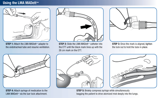 Buy Teleflex MADett Endotracheal Tube Mucosal Atomization Device 10/Case  online at Mountainside Medical Equipment