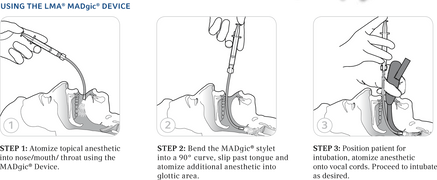 how to use Laryngo-Tracheal Mucosal Atomization Device