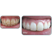 MI Paste Melon Flavor with Recaldent 40 Gram Tube Default Title