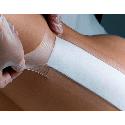 composite dressing Opsite Post Op Composite Dressings
