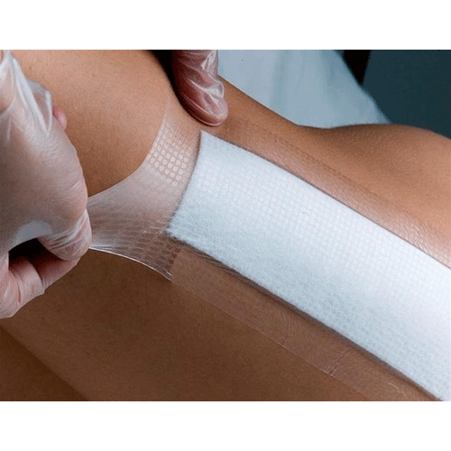 Buy Smith & Nephew Opsite Post Op Composite Dressings  online at Mountainside Medical Equipment