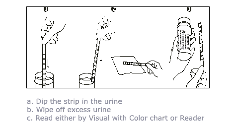Uristix 4 Reagent Strips For Urinalysis 100/Bottle — Mountainside ...