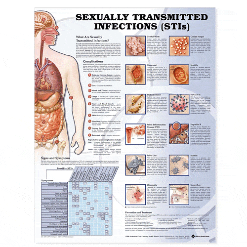 Public School Nursing office | Sexually Transmitted Infections Picture Chart 20 x 26