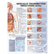 Sexually Transmitted Infections Picture Chart 20 x 26