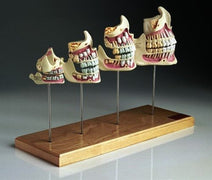 Buy n/a Four Teeth and Jaw Development Set Models, Newborn to Adult  online at Mountainside Medical Equipment