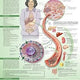 Understanding Type 2 Diabetes Poster 20 x 26