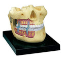 Upper and Lower Jaw Two-Piece Model, Hand-Painted